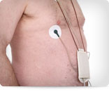 24-Hour-Holter-Monitor